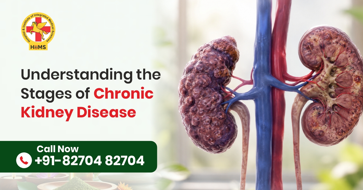 Chronic Kidney Disease: Why Understanding the Stages Matters for Better Kidney Health