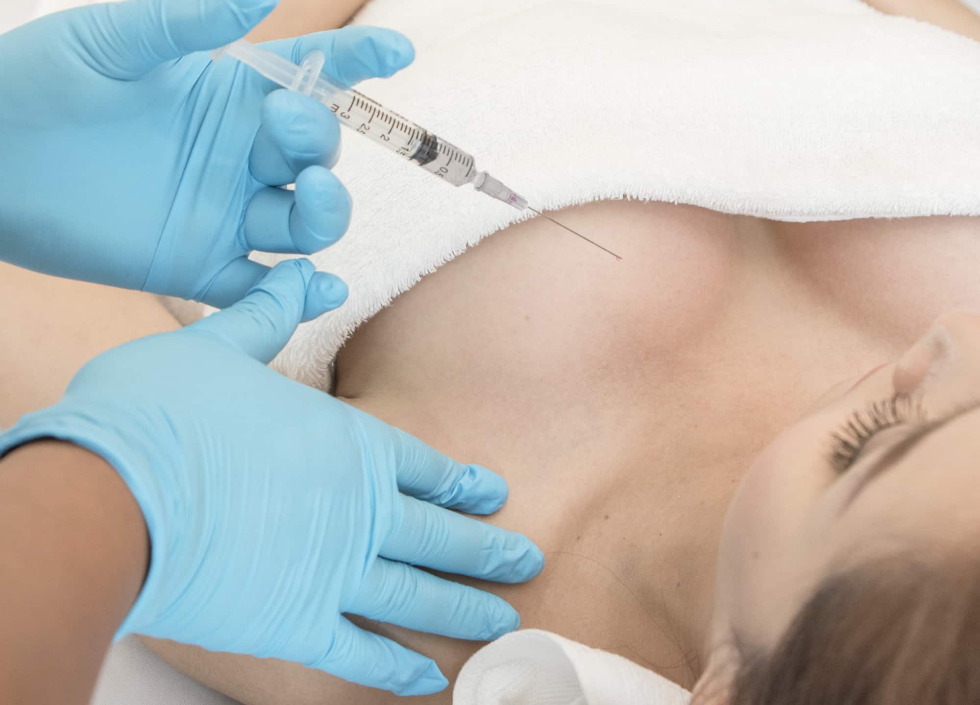 What Are Body Fillers Used for in Modern Aesthetics?