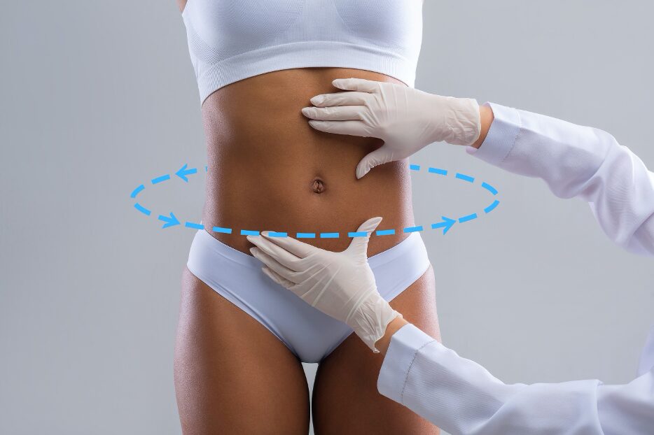 What Are the Benefits of GPS Laser Liposuction?
