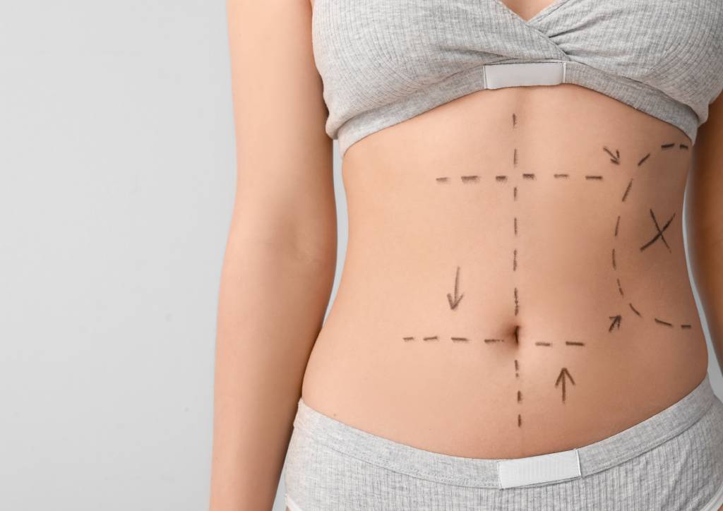 What Factors Affect Tummy Tuck Recovery Time?