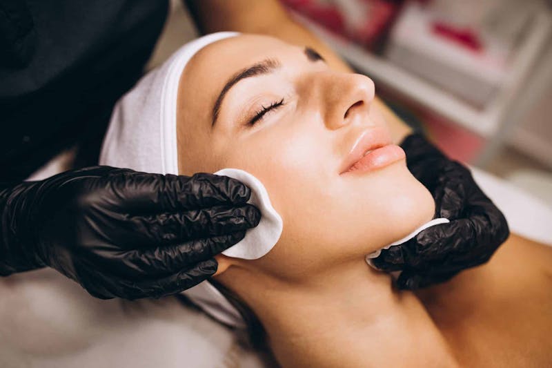 What Is a Chemical Peel and How Does It Work?