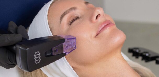 What Makes Morpheus8 Effective for Skin Remodeling?