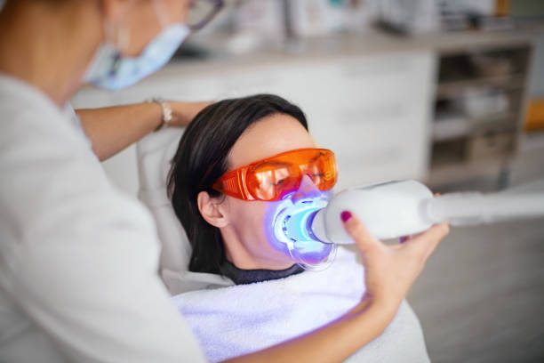 Types of Teeth Whitening Treatment and How Do They Work?