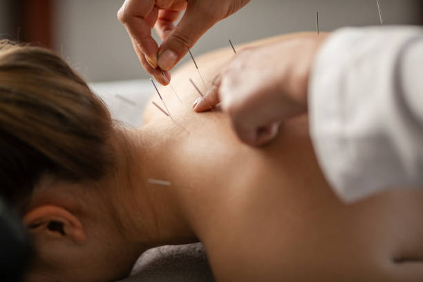 Top Health Benefits of Acupuncture for Pain Relief, Stress, and Sleep Problems