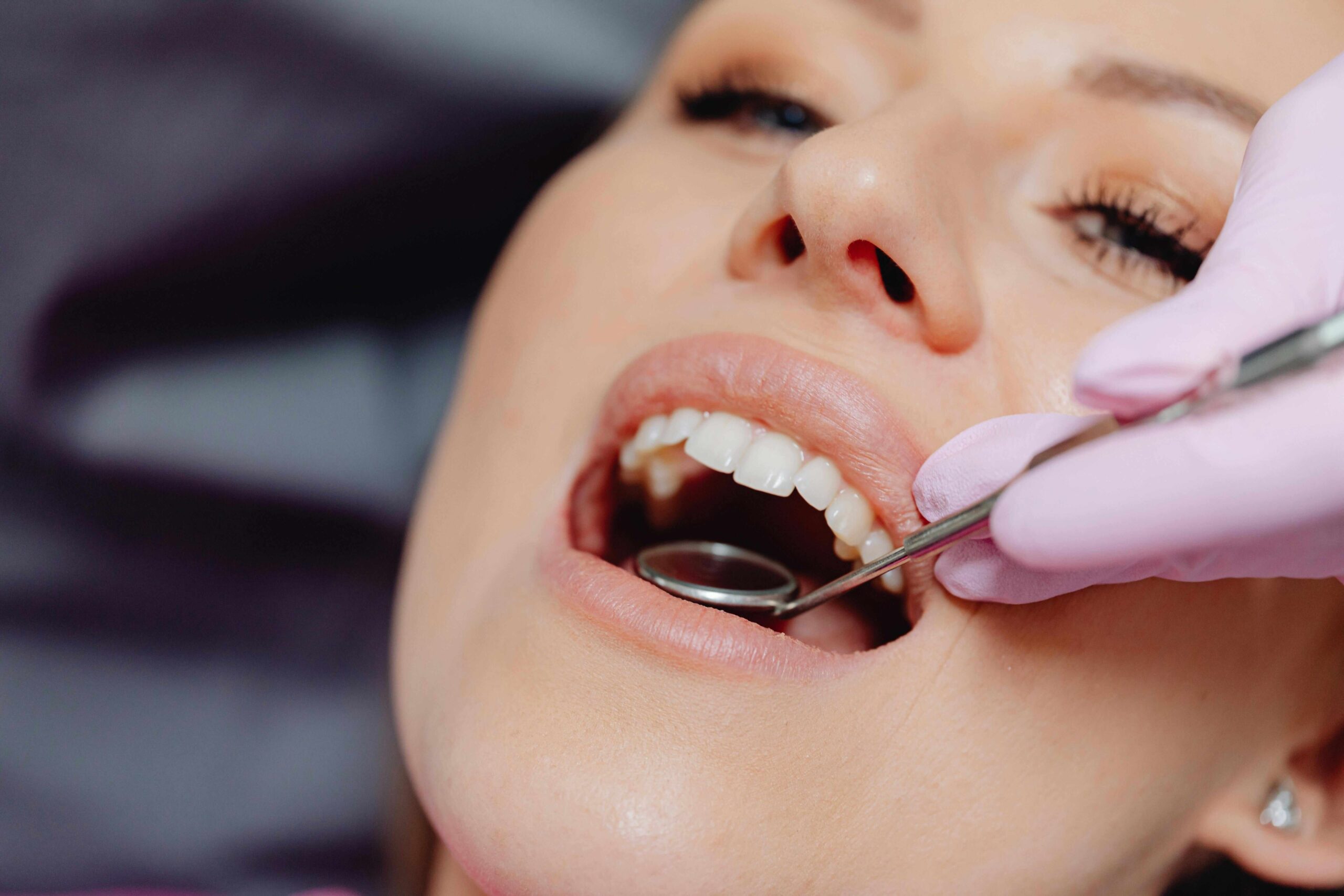 How Much Are Implant Costs in Turkey for UK Patients?