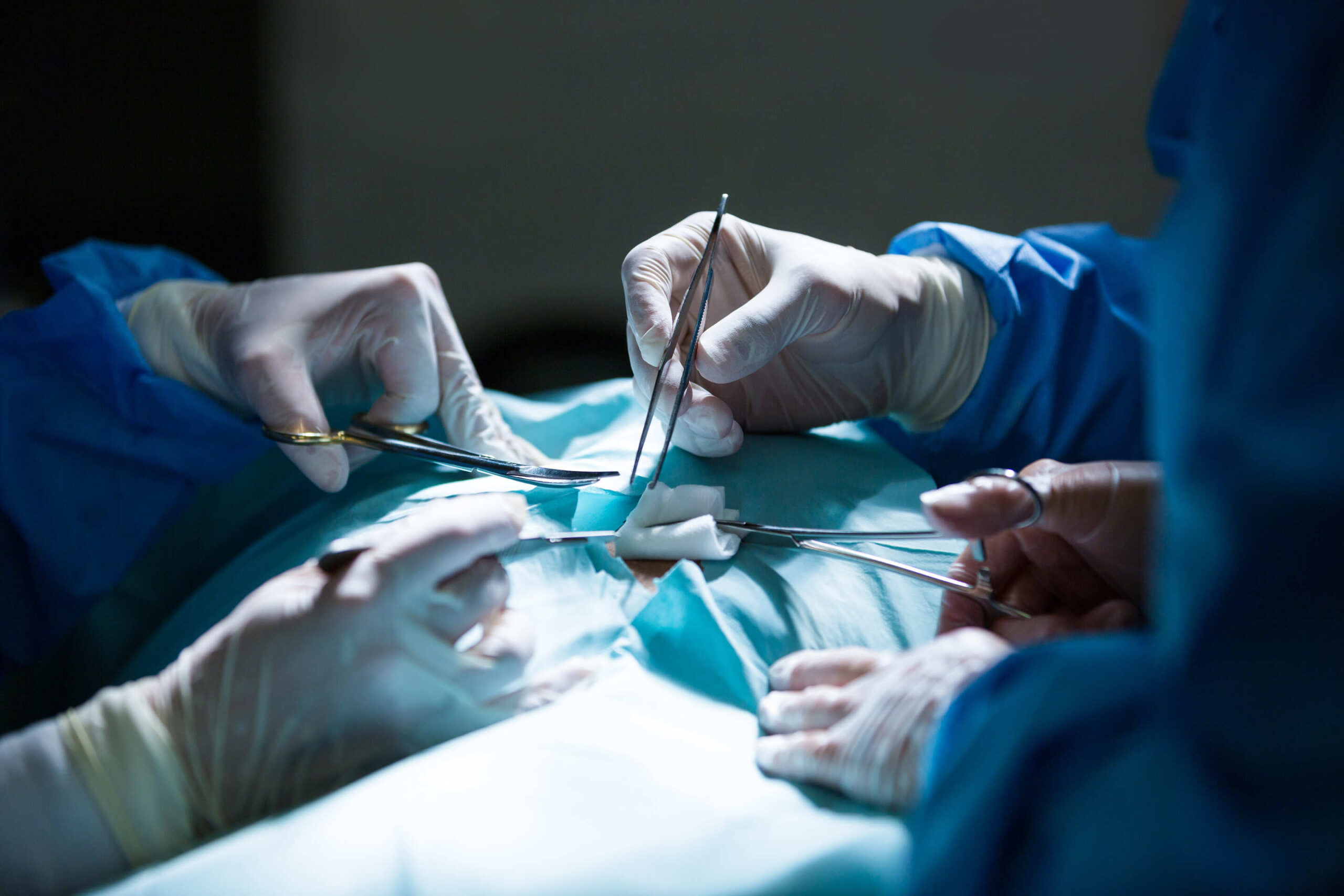 Understanding General and Laparoscopic Surgery: A Guide for Patients