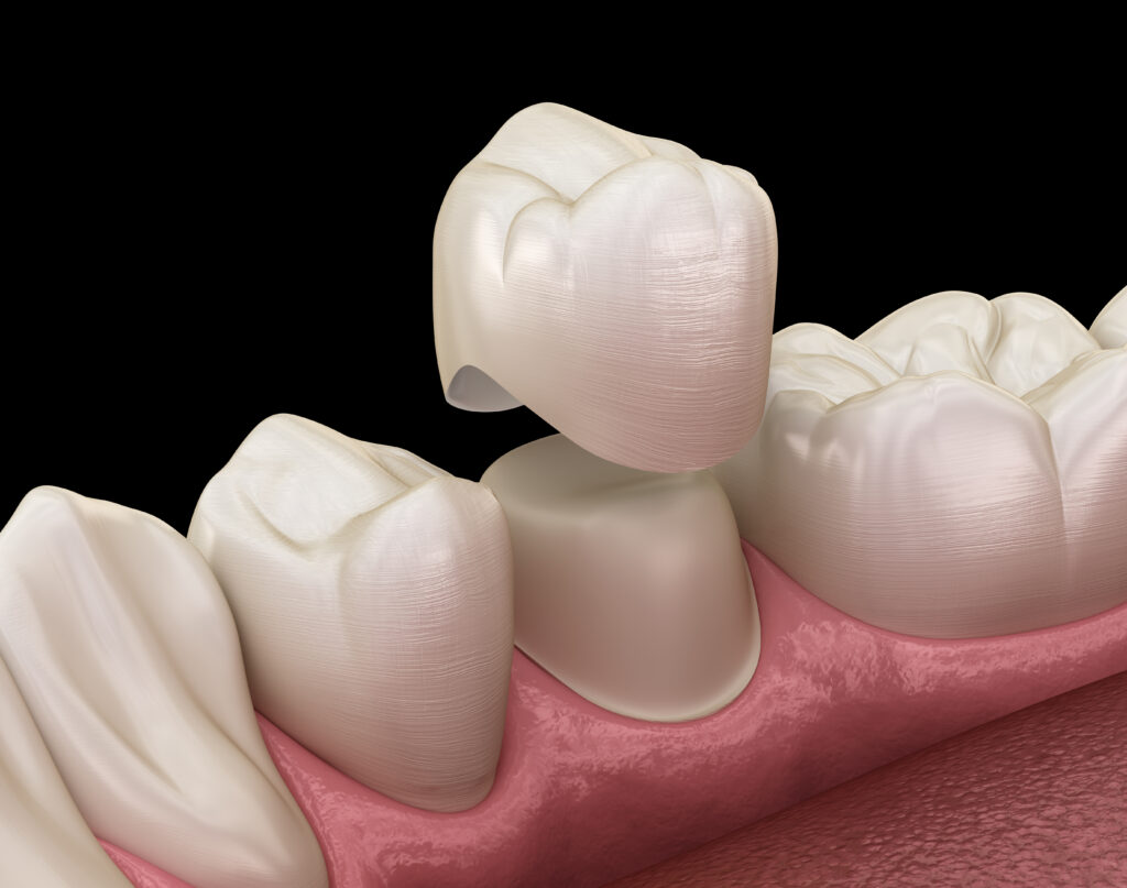 Children Orthodontic Treatment in Bikaner: Building Healthy Smiles from an Early Age