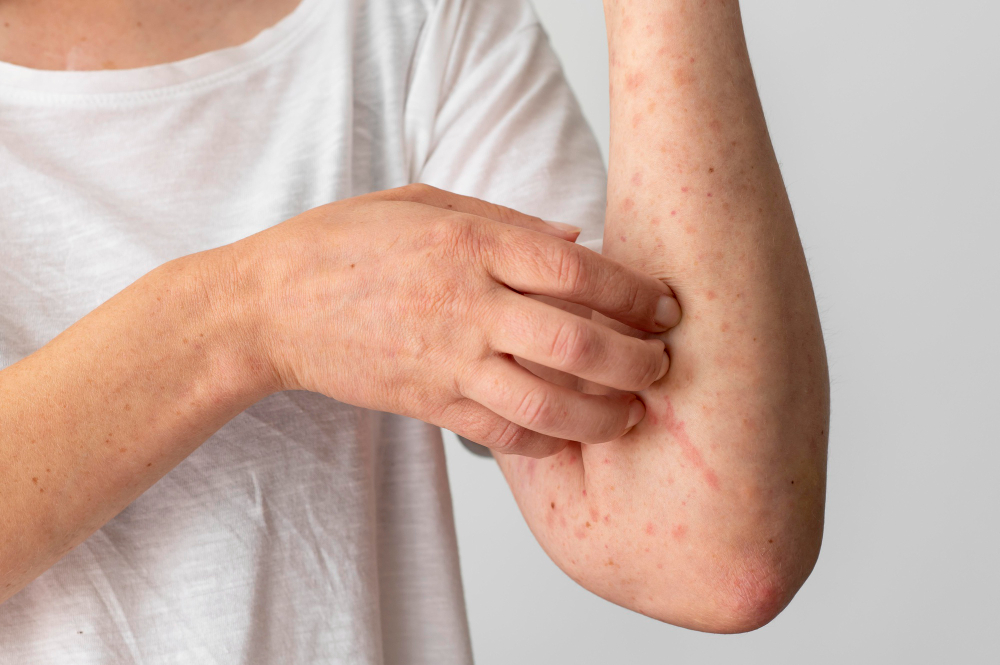 I have a recurrent skin infection. How will a dermatologist help?