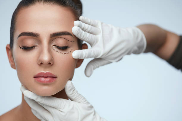 Does Eyelid Surgery Help Reduce the Appearance of Tired-Looking Eyes?