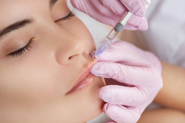 Does Lip Fillers Injections Reduce Thin Lips?