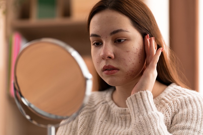 Does Skin Diseases Treatment in Abu Dhabi Reduce Redness