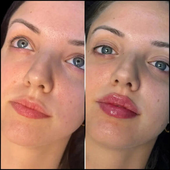 Best Plastic Surgeons in Dubai for High-Quality Cosmetic Procedures