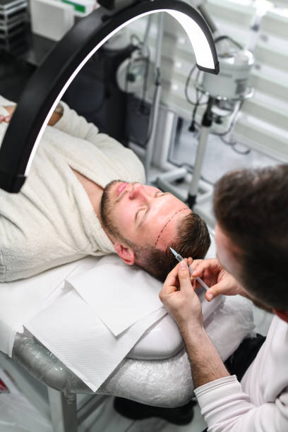 How Can FUE Hair Transplant Transform Your Look?
