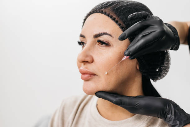 How Can JAWLINE FILLERS Refresh Your Appearance?