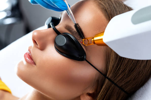 How Can Laser Carbon Peel Boost Skin Confidence?