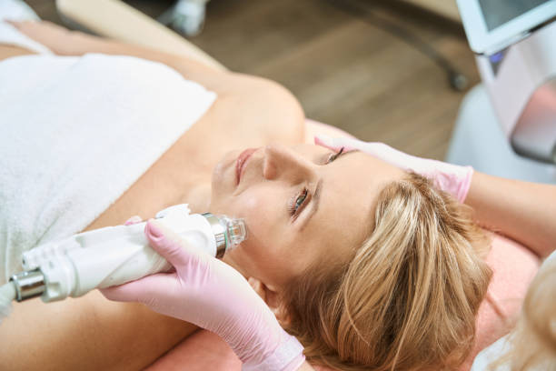 How Can Microneedling Treatment Reduce Large Pores?