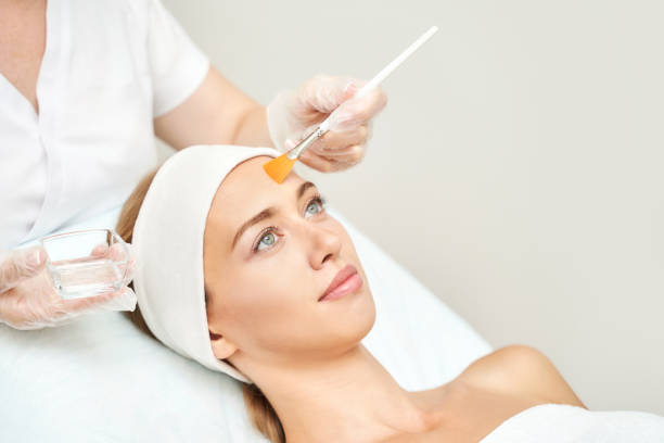 How Do Chemical Peels Support a Youthful Skin Appearance?