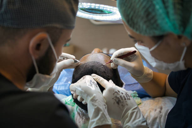 How Does DHI Hair Transplant Enhance Hair Coverage?