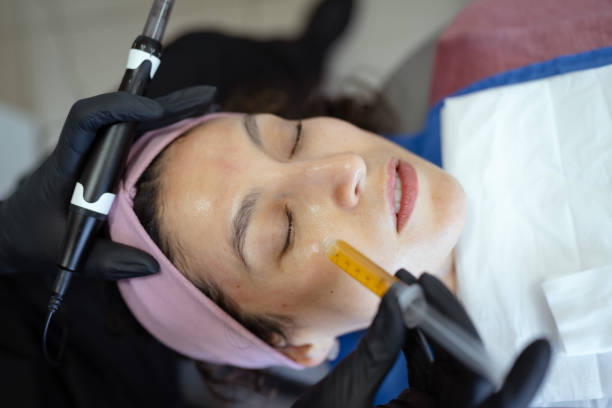 How Does Microneedling in Abu Dhabi Enhance Skin Glow?