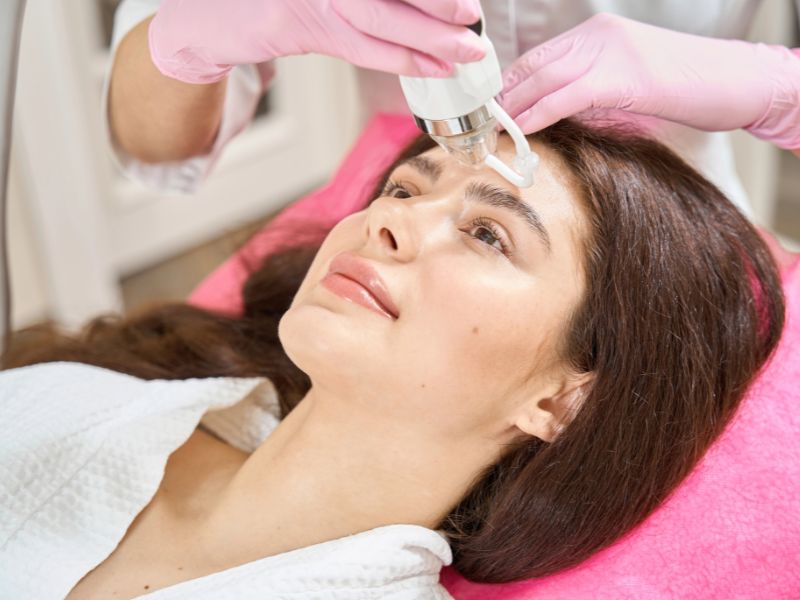 How Effective Is Fractional RF Micro Needling