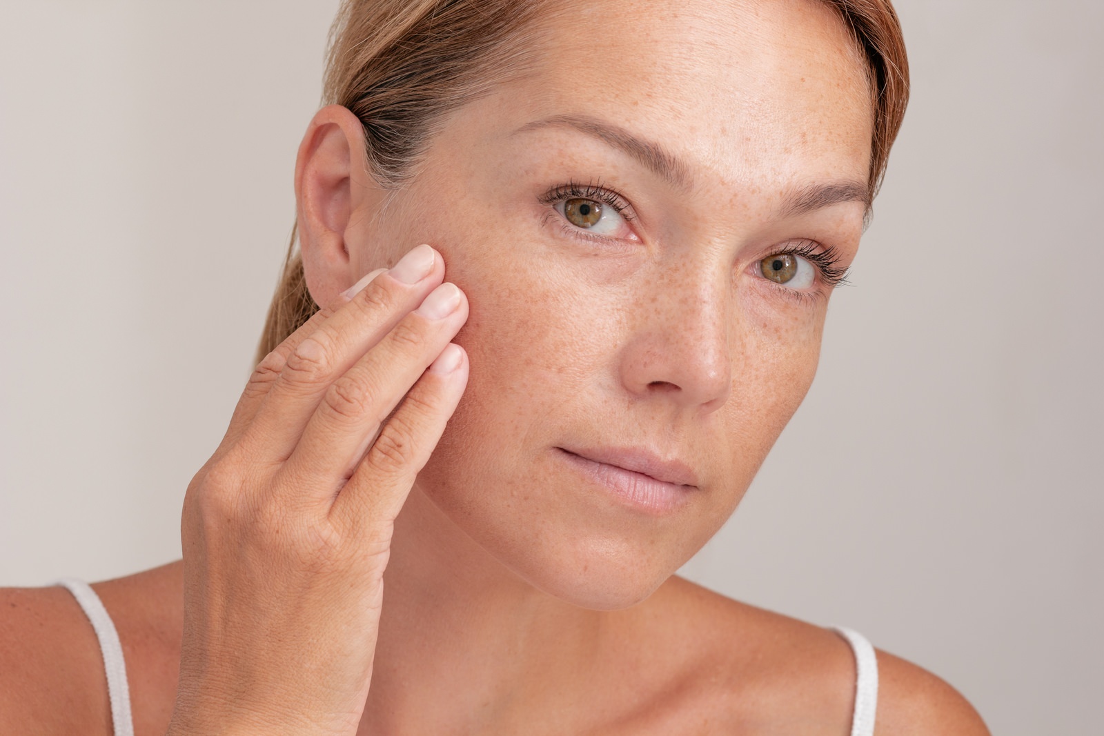 How Effective Is Melasma Treatment in Abu Dhabi for Women