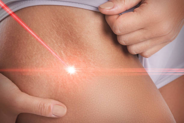How Is skin lesion removal in Abu Dhabi Managed With New Techniques?
