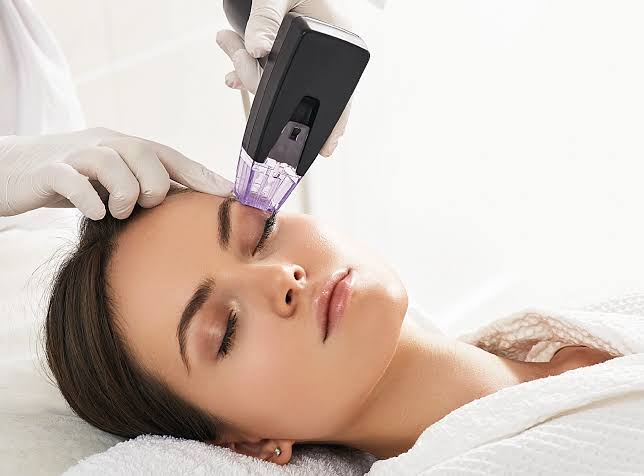How Long Does Morpheus8 Treatment Last for Skin Rejuvenation and Tightening?