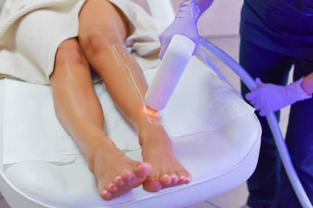 How Safe Is Laser Hair Removal During Summer?