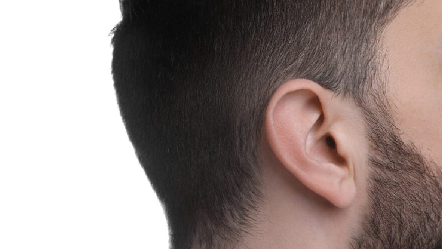How Sideburn Hair Transplant Boosts Confidence