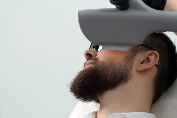 Is Beard Laser Hair Removal the Permanent solution?