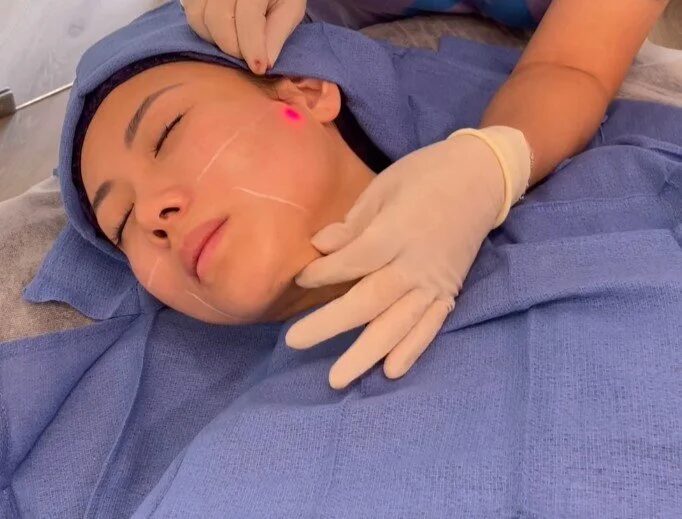 Is EndoLift Abu Dhabi Suitable for All Skin Types