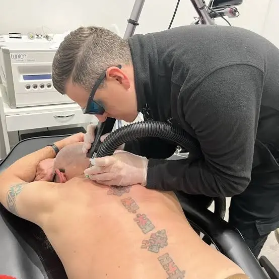 Is Laser Tattoo Removal the Best Option for You?