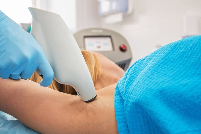 Is MiraDry Treatment in Abu Dhabi a Permanent Solution?
