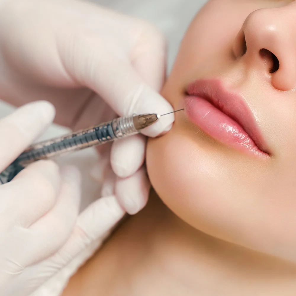 Reveal Soft and Youthful Lips with Lip Fillers