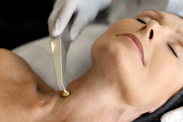 What Are the Benefits of Morpheus 8 Treatment Today?