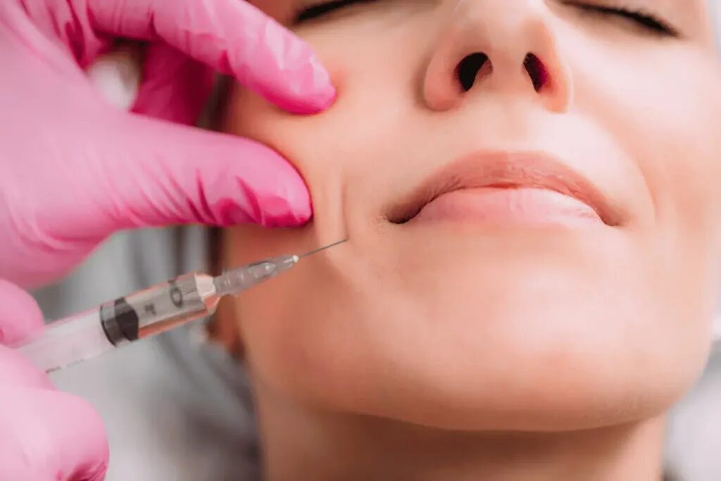 What Are the Benefits of Volift Fillers in Abu Dhabi?