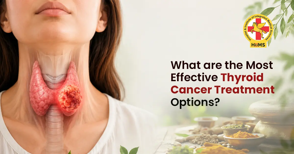 Thyroid Cancer Treatment: A Clear Guide to Care, Symptoms, and Support