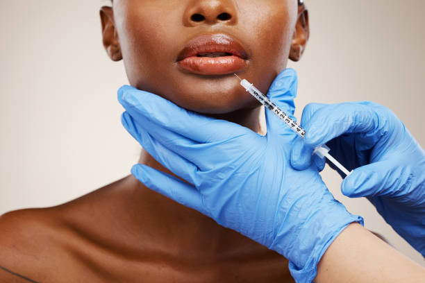 What Can Dermal Fillers Do for Aging Facial Features?