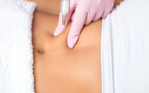 What Happens During Fat Dissolving Injections?