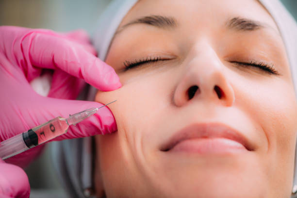 What Makes Cheek Fillers Ideal for Volume Restoration?