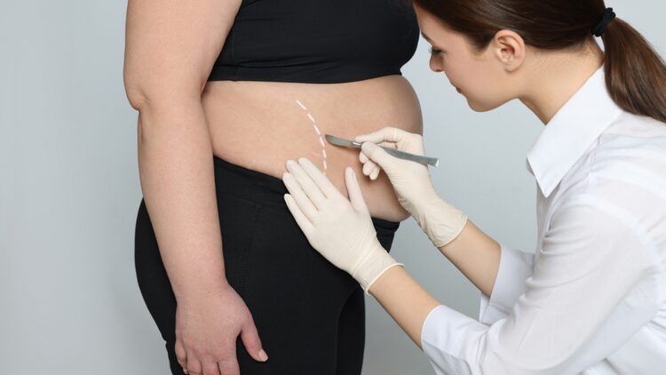 What Makes Gastric Botox in Abu Dhabi So Popular Today