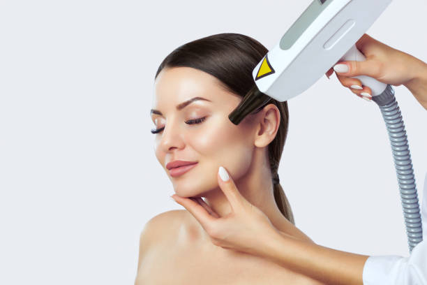 What Skin Problems Can Laser Carbon Peel Treat?