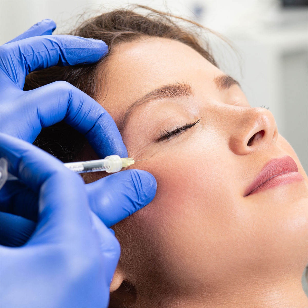 Botox Injections in London: Everything You Should Know