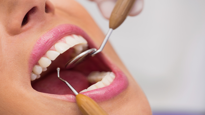 4 Major Advantages of Choosing Dental Implants to Replace Missing Teeth