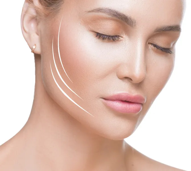 Endolift in London: A Modern Approach to Skin Tightening