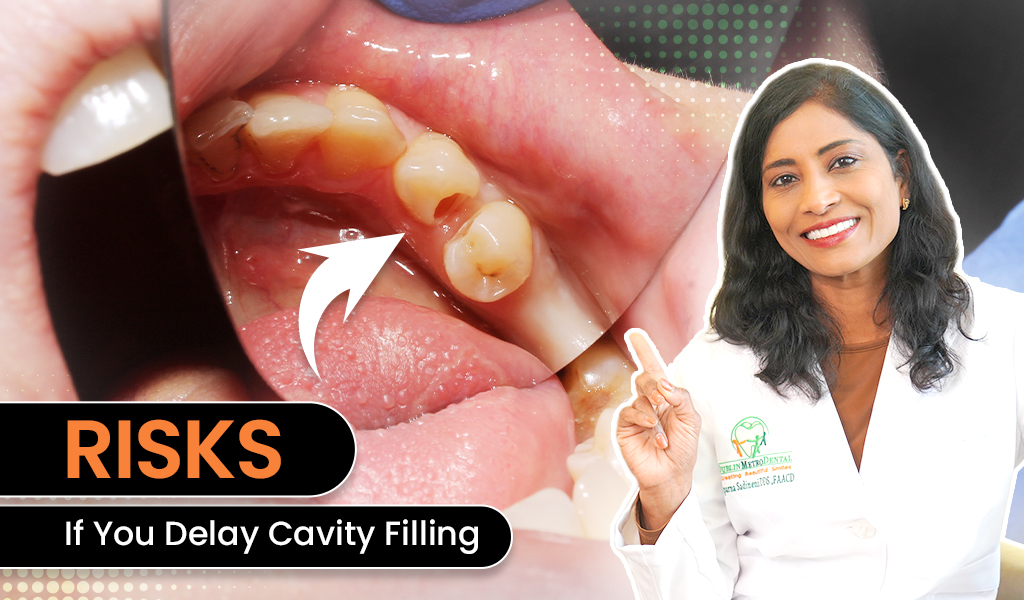 Do Cavity Fillings Hurt? What Patients Should Expect